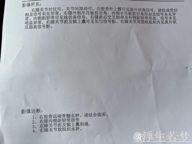 詹姆斯左膝内侧副韧带二级扭伤确诊